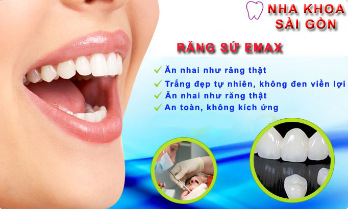 Răng sứ emax - đỉnh cao công nghệ răng sứ